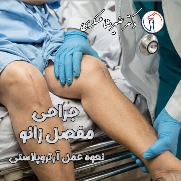 جراحی مفصل زانو در تهران - دکتر علیرضا عسکری