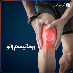روماتیسم زانو و درمان آن در تهران - دکتر عسکری