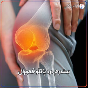 درمان سندروم درد پاتلو فمورال - دکتر عسکری