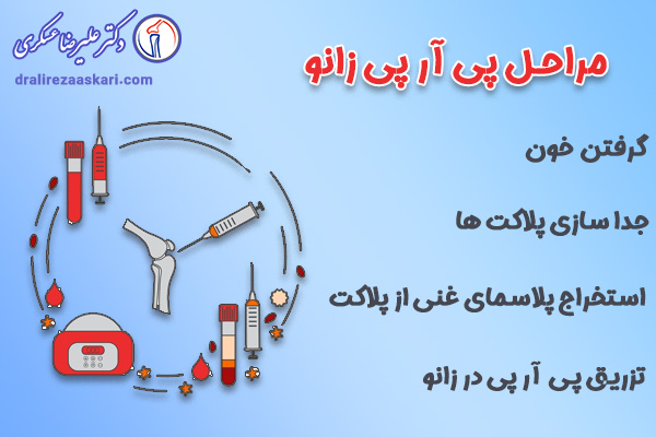 مراحل تزریق پی آر پی زانو - دکتر علیرضا عسکری
