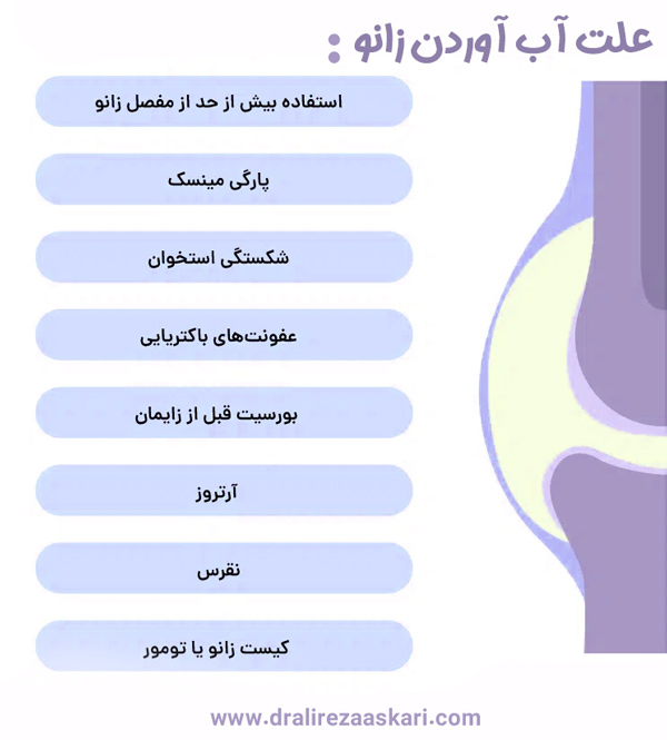 آب آوردن زانو - دکتر علیرضا عسکری