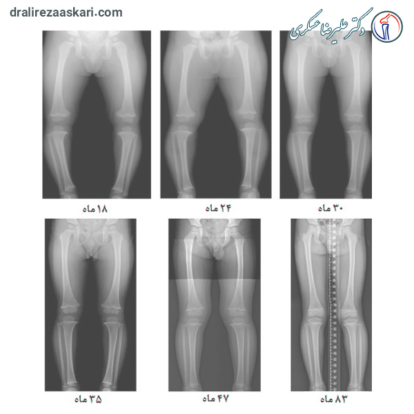 پای پرانتزی - دکتر علیرضا عسکری