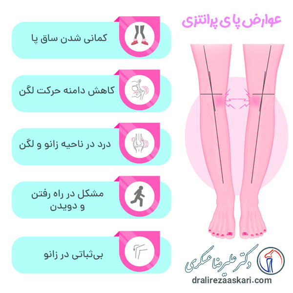 عوارض پای پرانتزی - دکتر عسکری