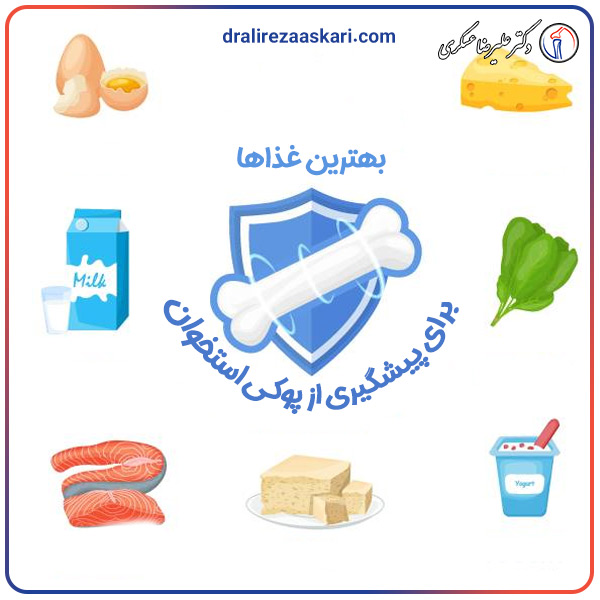 پوکی استخوان - دکتر عسکری