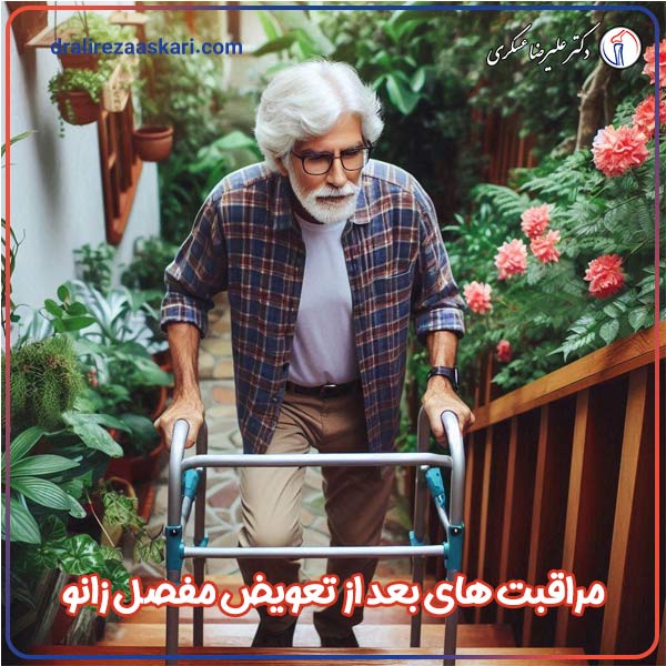 بالارفتن از پله ها بعد از تعویض مفصل زانو - دکتر عسکری
