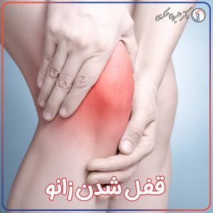 قفل شدن زانو - دکتر علیرضا عسکری