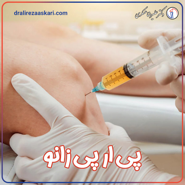 پی ار پی زانو - دکتر علیرضا عسکری