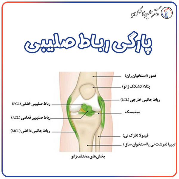 پارگی رباط صلیبی - دکتر عسکری