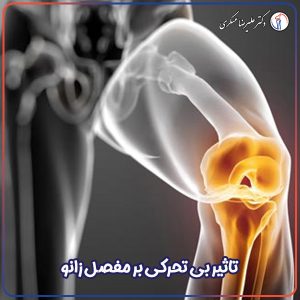 تاثیر بی تحرکی در مفصل زانو - دکتر علیرضا عسکری