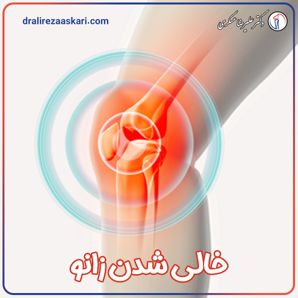 خالی شدن زانو - دکتر علیرضا عسکری