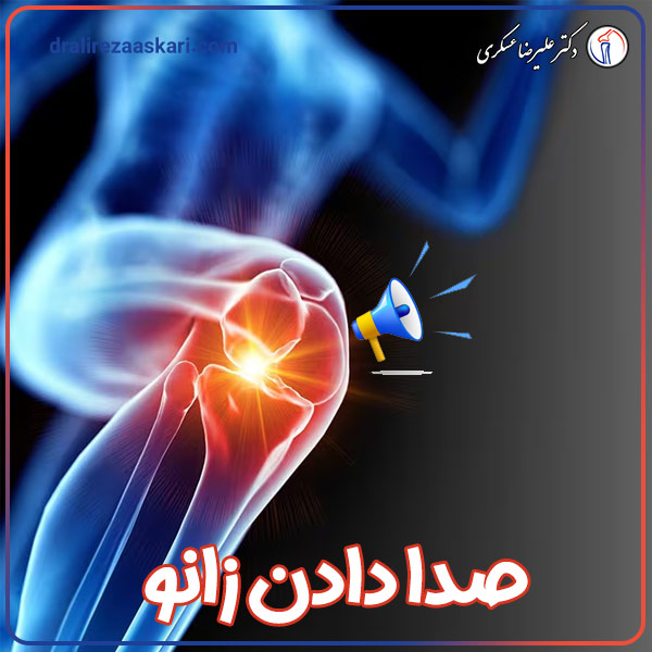 صدا دادن زانو - دکتر علیرضا عسکری