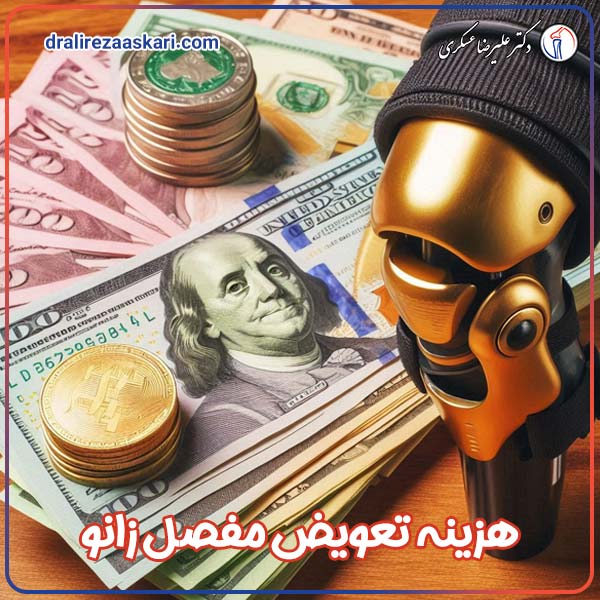 هزینه تعویض مفصل زانو - دکتر علیرضا عسکری