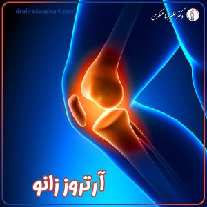 آرتروز زانو - دکتر علیرضا عسکری
