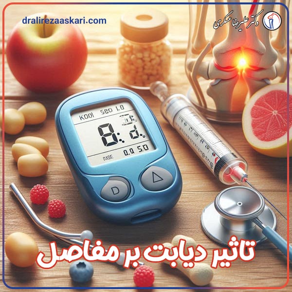 تاثیر دیابت بر مفاصل - دکتر علیرضا عسکری