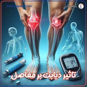 تاثیر دیابت بر مفاصل - دکتر علیرضا عسکری