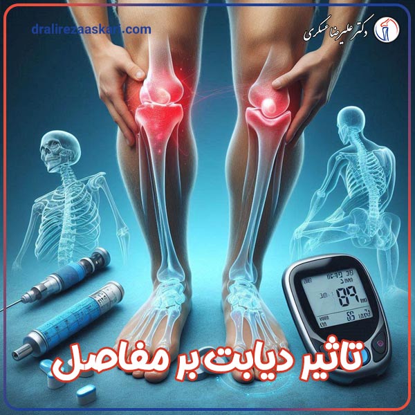تاثیر دیابت بر مفاصل - دکتر علیرضا عسکری