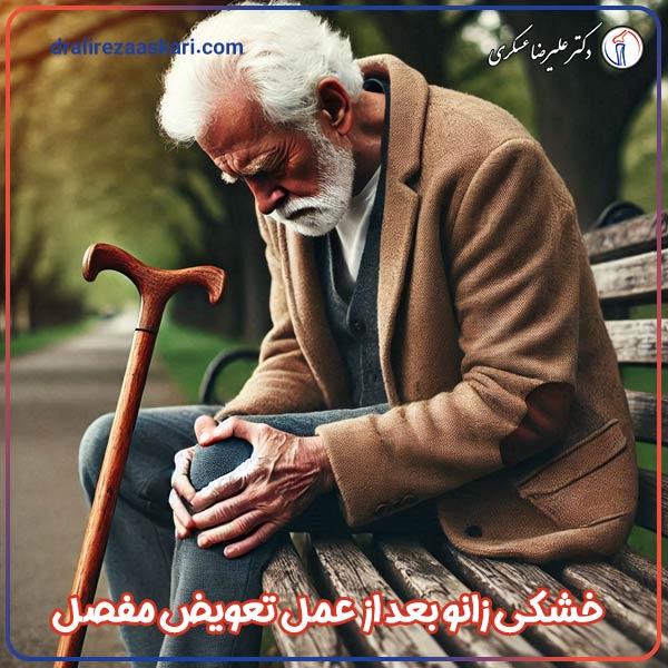 خشکی زانو بعد از تعویض مفصل - دکتر علیرضا عسکری