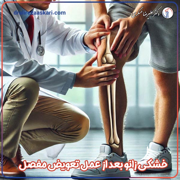 خشکی زانو بعد از تعویض مفصل - دکتر علیرضا عسکری