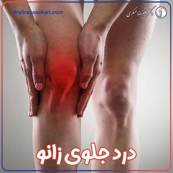 درد جلوی زانو - دکتر علیرضا عسکری