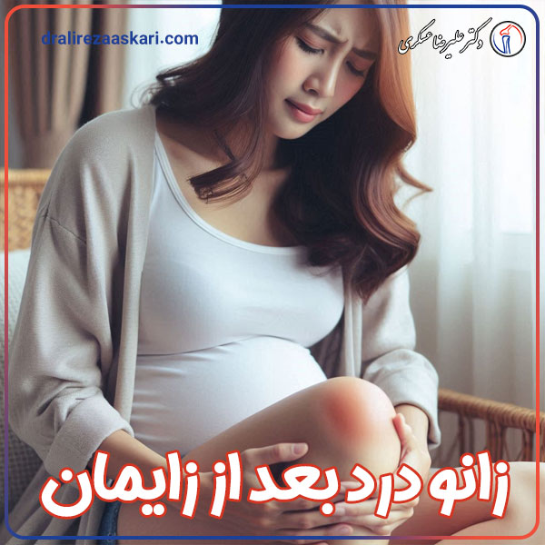 زانو درد بعد از زایمان - دکتر عسکری