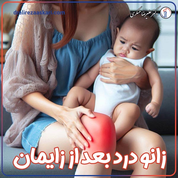 زانو درد بعد از زایمان - دکتر عسکری