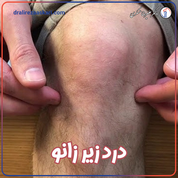 درد زیر زانو - دکتر عسکری
