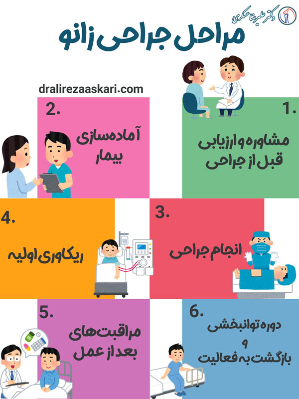 مراحل جراحی زانو - دکتر علیرضا عسکری