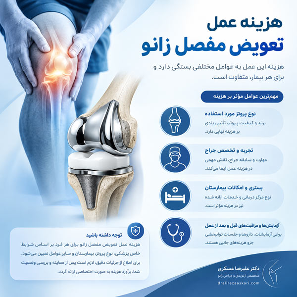 هزینه تعویض مفصل زانو - دکتر عسکری