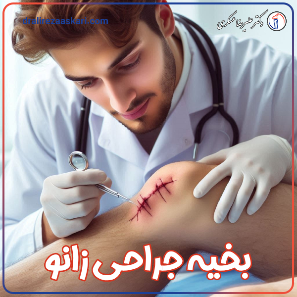 کشیدن بخیه جراحی زانو - دکتر علیرضا عسکری