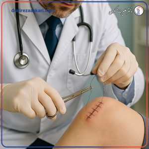 کشیدن بخیه زانو - دکتر علیرضا عسکری