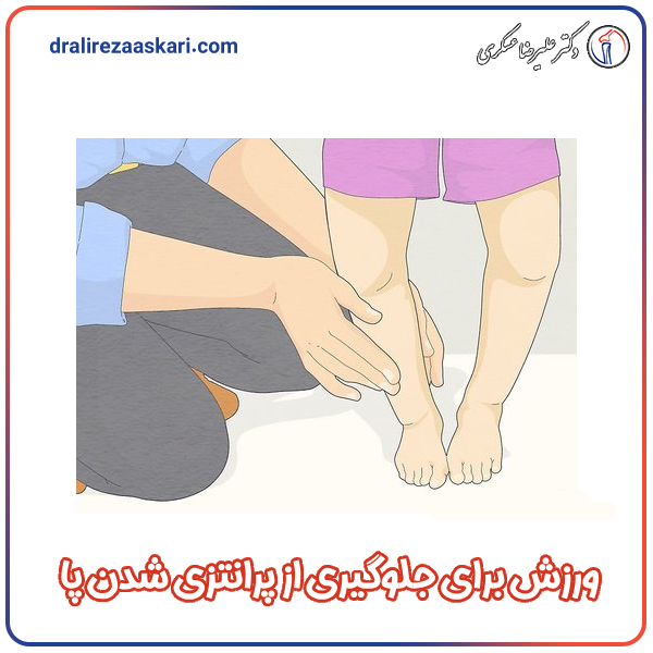 ورزش برای جلوگیری از پرانتزی شدن پا در کودکان - دکتر عسکری