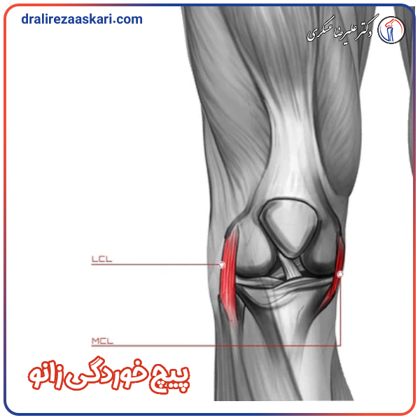 پیچ خوردگی زانو - دکتر علیرضا عسکری