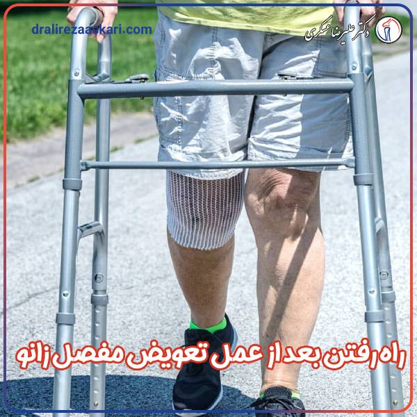 راه رفتن بعد از عمل تعویض مفصل زانو - دکتر علیرضا عسکری