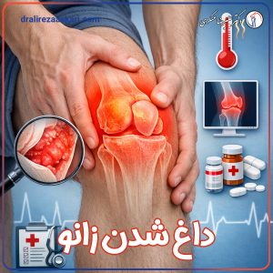 داغ شدن زانو - دکتر علیرضا عسکری