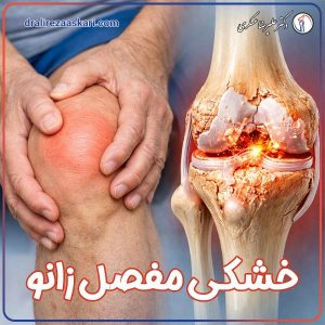 خشکی مفصل زانو - دکتر علیرضا عسکری