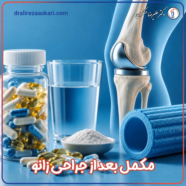 مصرف مکمل بعد از جراحی زانو - دکتر عسکری