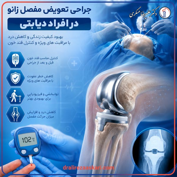 تعویض مفصل زانو در افراد دیابتی - دکتر عسکری
