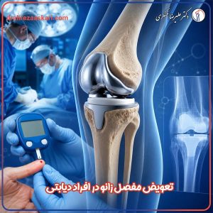 تعویض مفصل زانو در افراد دیابتی - دکتر عسکری