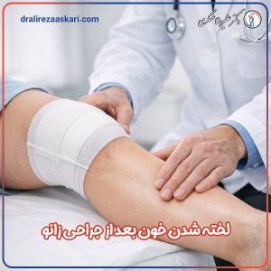 لخته شدن خون بعد از جراحی زانو - دکتر عسکری