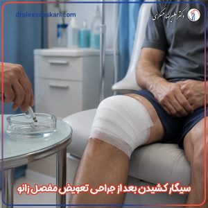 سیگار کشیدن بعد از جراحی تعویض مفصل زانو - دکتر عسکری
