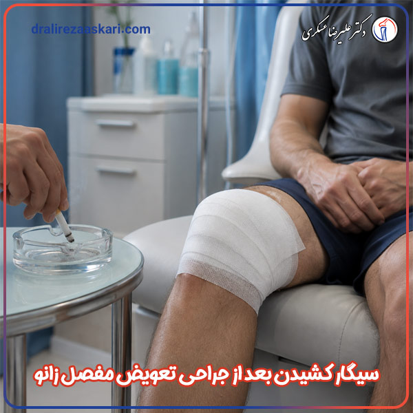 سیگار کشیدن بعد از جراحی تعویض مفصل زانو - دکتر عسکری