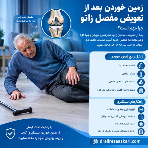 زمین خوردن بعد از تعویض مفصل زانو - دکتر عسکری