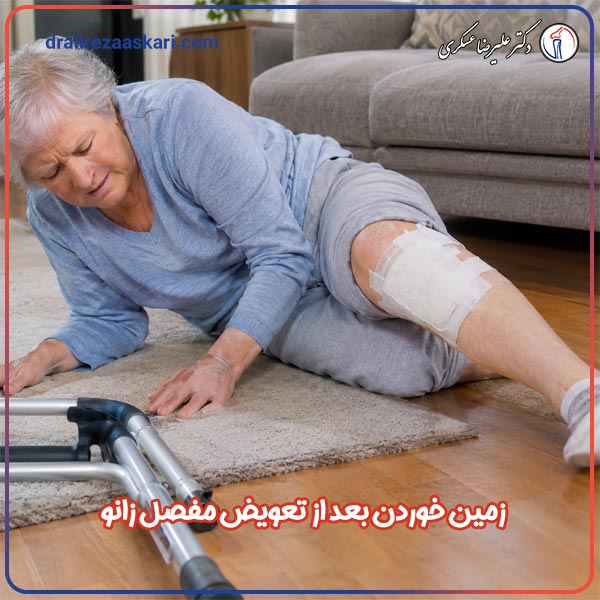 زمین خوردن بعد از تعویض مفصل زانو - دکتر عسکری