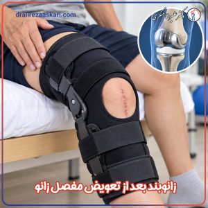 زانوبند بعد از تعویض مفصل زانو - دکتر عسکری