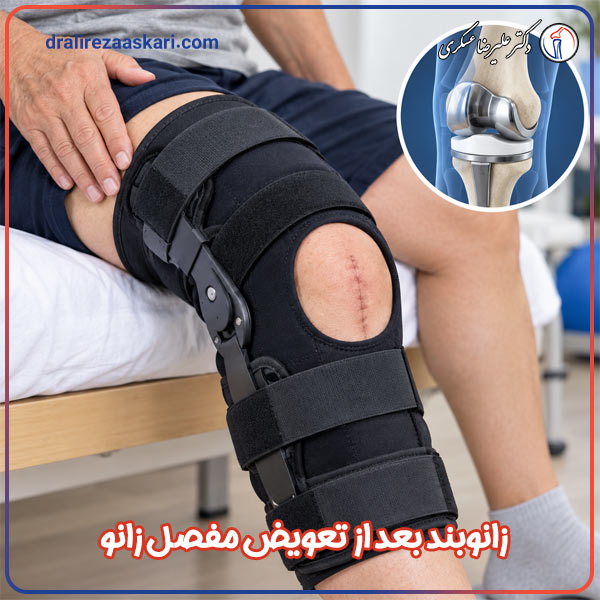 زانوبند بعد از تعویض مفصل زانو - دکتر عسکری